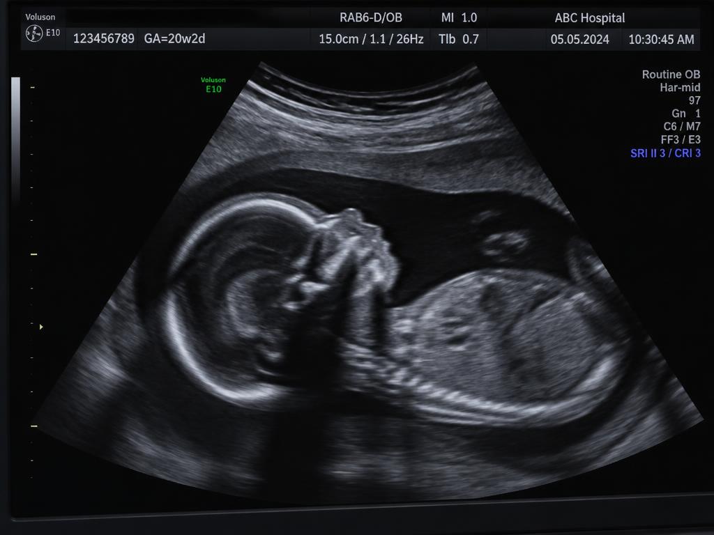 Saúde fetal — Obstétrica